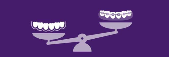 rendering of a scale with invisalign on one side and braces on another side