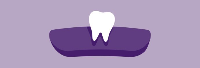 a rendering of a loose tooth
