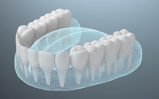 3d rendering of teeth in a mouth