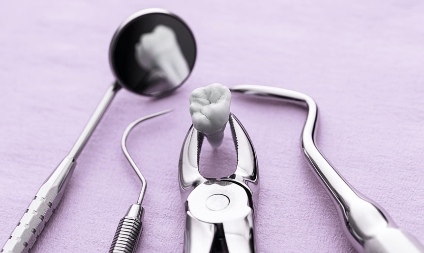 oral surgery equipment on purple paper