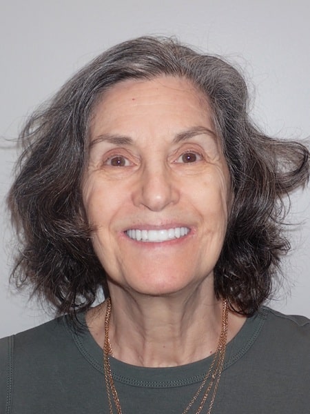 After picture of our patient, Laurel