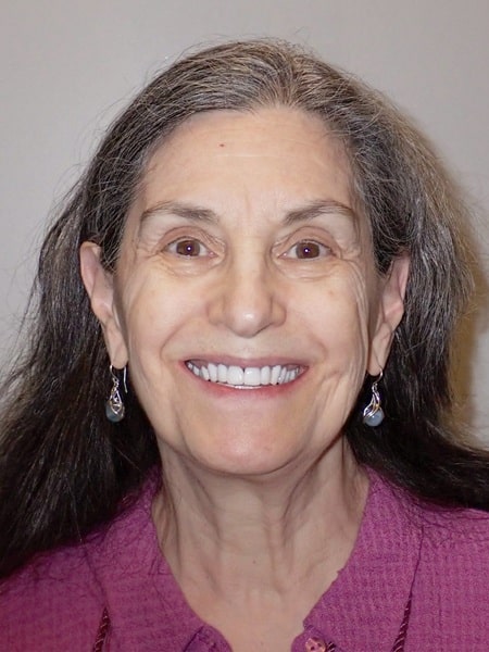 Before picture of our patient, Laurel