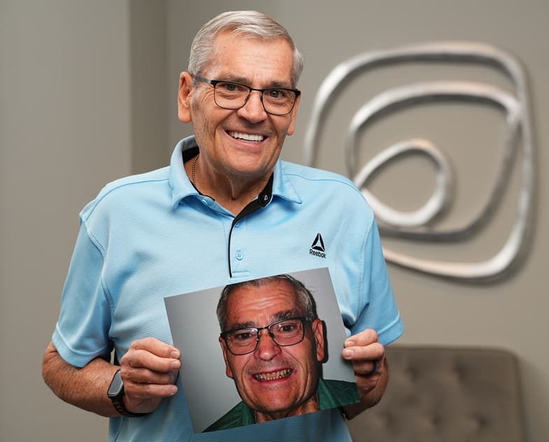 Lon, an All-on-X dental implant patient at Longmont Dental Loft, smiling while holding his before photo.