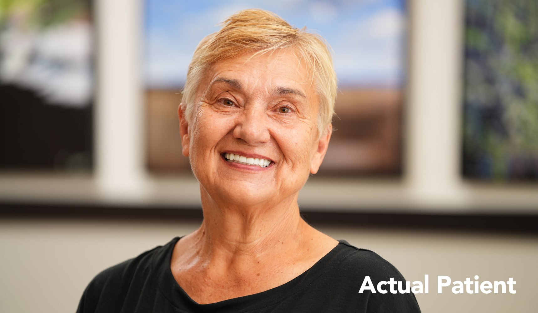 Marianne smiling in an after headshot following her dental implants treatment at Longmont Dental Loft.